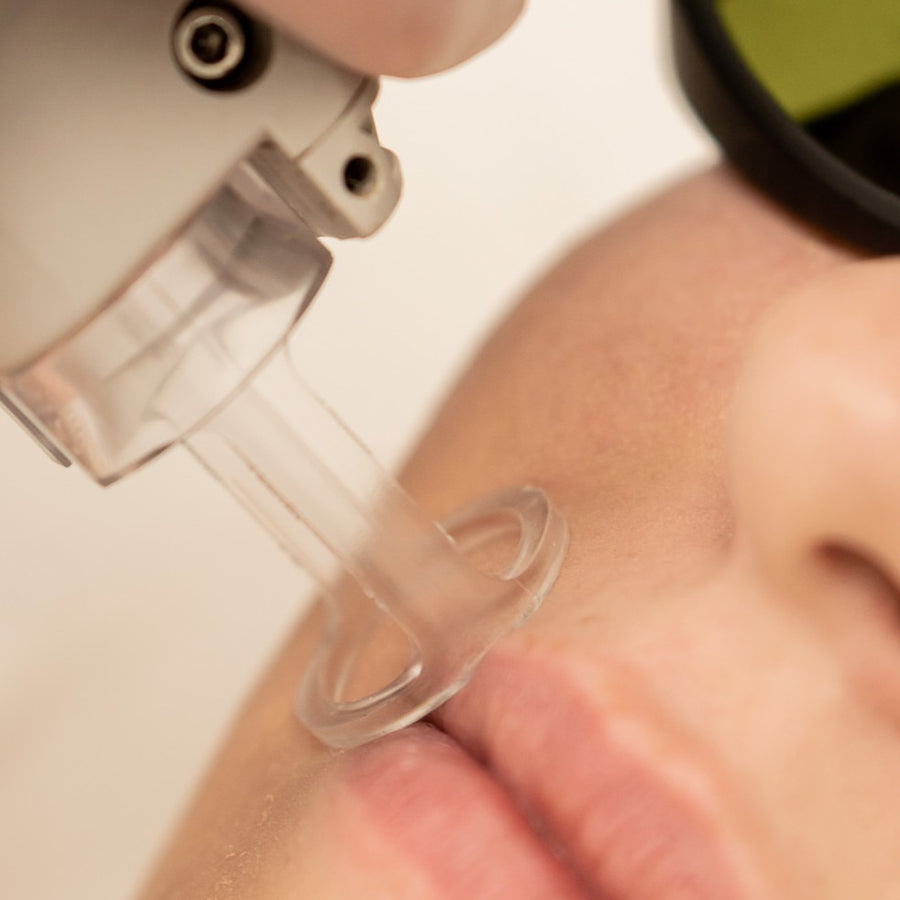 Full Neck Laser Hair Removal Services