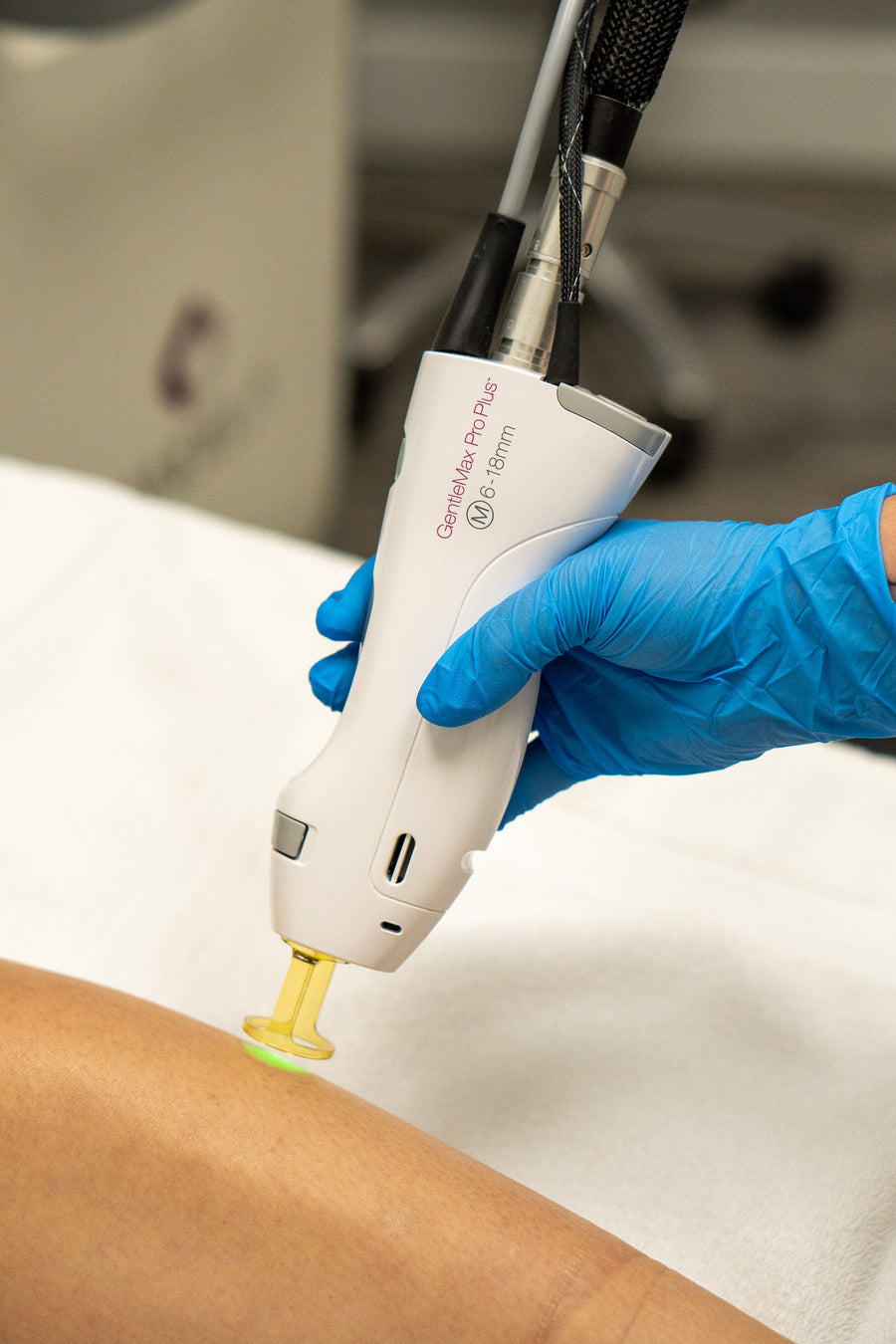 Underarms Laser Hair Removal Services