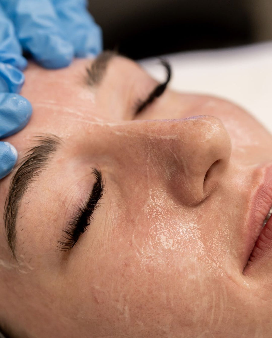 Deluxe HydraFacial