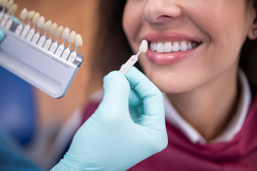 Smile FX Teeth Whitening