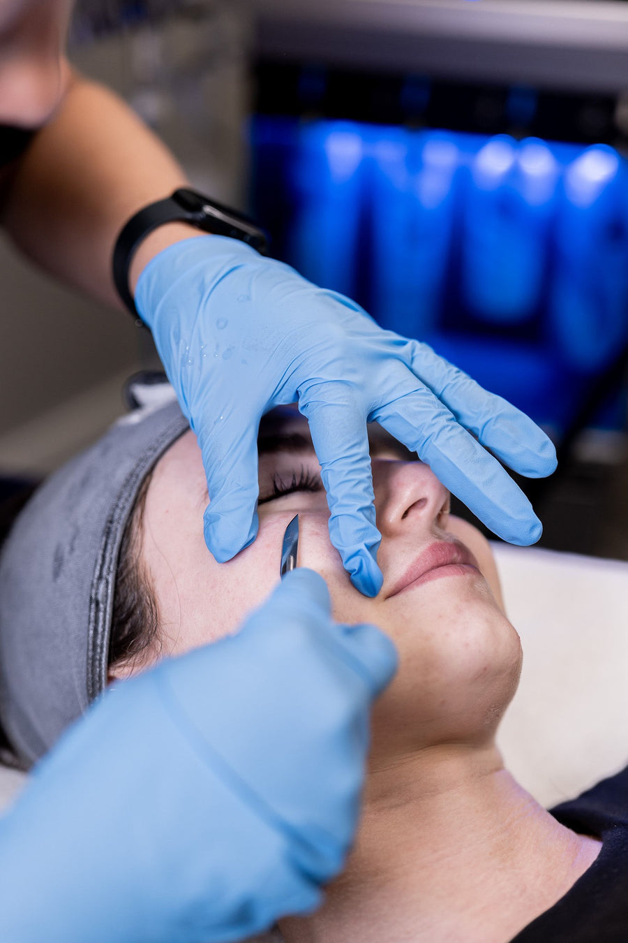Dermaplaning
